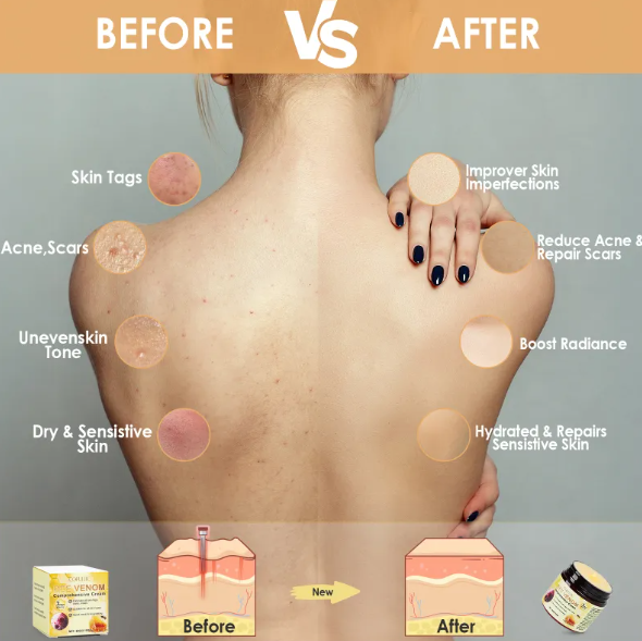Honey Glow - Bee Venom Cream